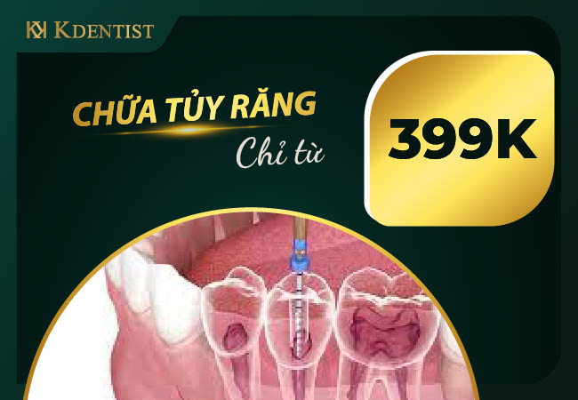 Giá chữa tủy răng Giá chữa tủy răng