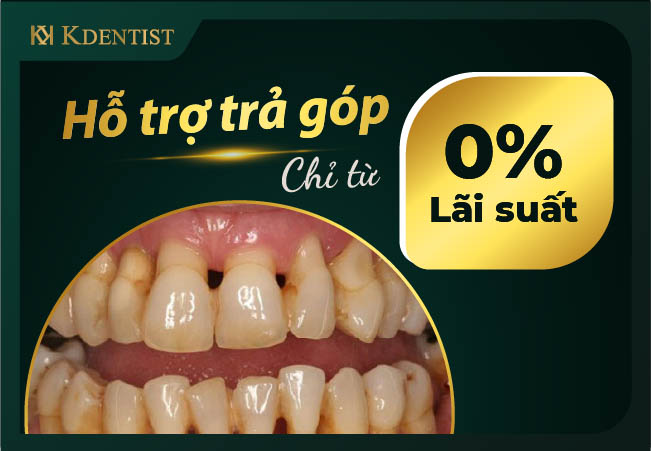 Trả góp 0% Trả góp 0%