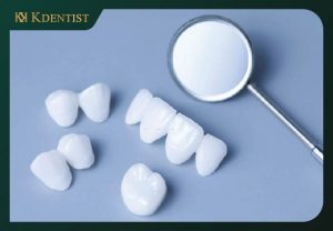 Mẫu răng sứ đa dạng Mẫu răng sứ đa dạng