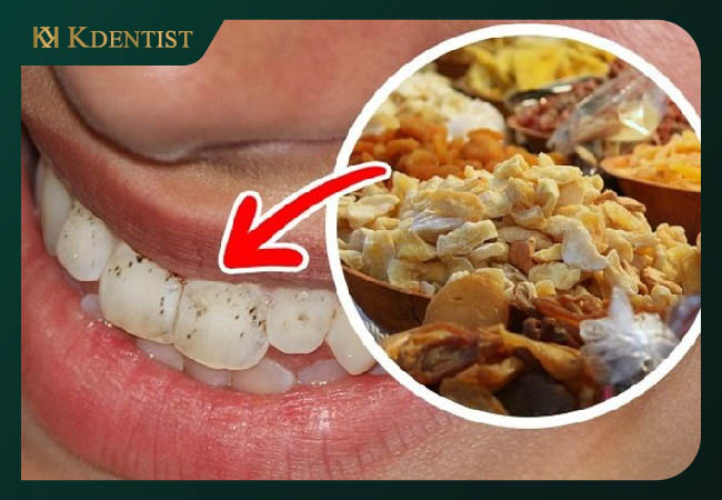 Ăn thức ăn có chứa nhiều phẩm màu