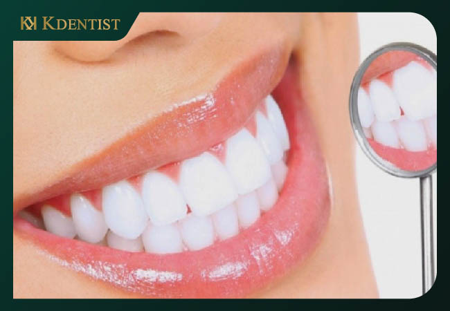 Tẩy trắng răng thẩm mỹ Tẩy trắng răng thẩm mỹ