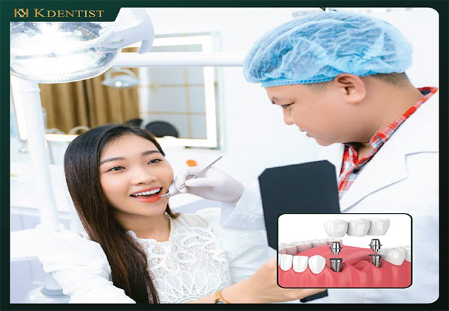 Bác sĩ tư vấn bảo hành răng implant cho khách hàng Bác sĩ tư vấn bảo hành răng implant cho khách hàng