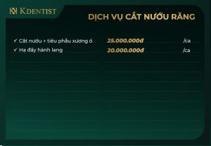 Bảng giá điều trị cười hở lợi Bảng giá điều trị cười hở lợi