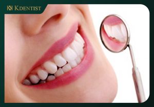 Trám răng thẩm mỹ Trám răng thẩm mỹ