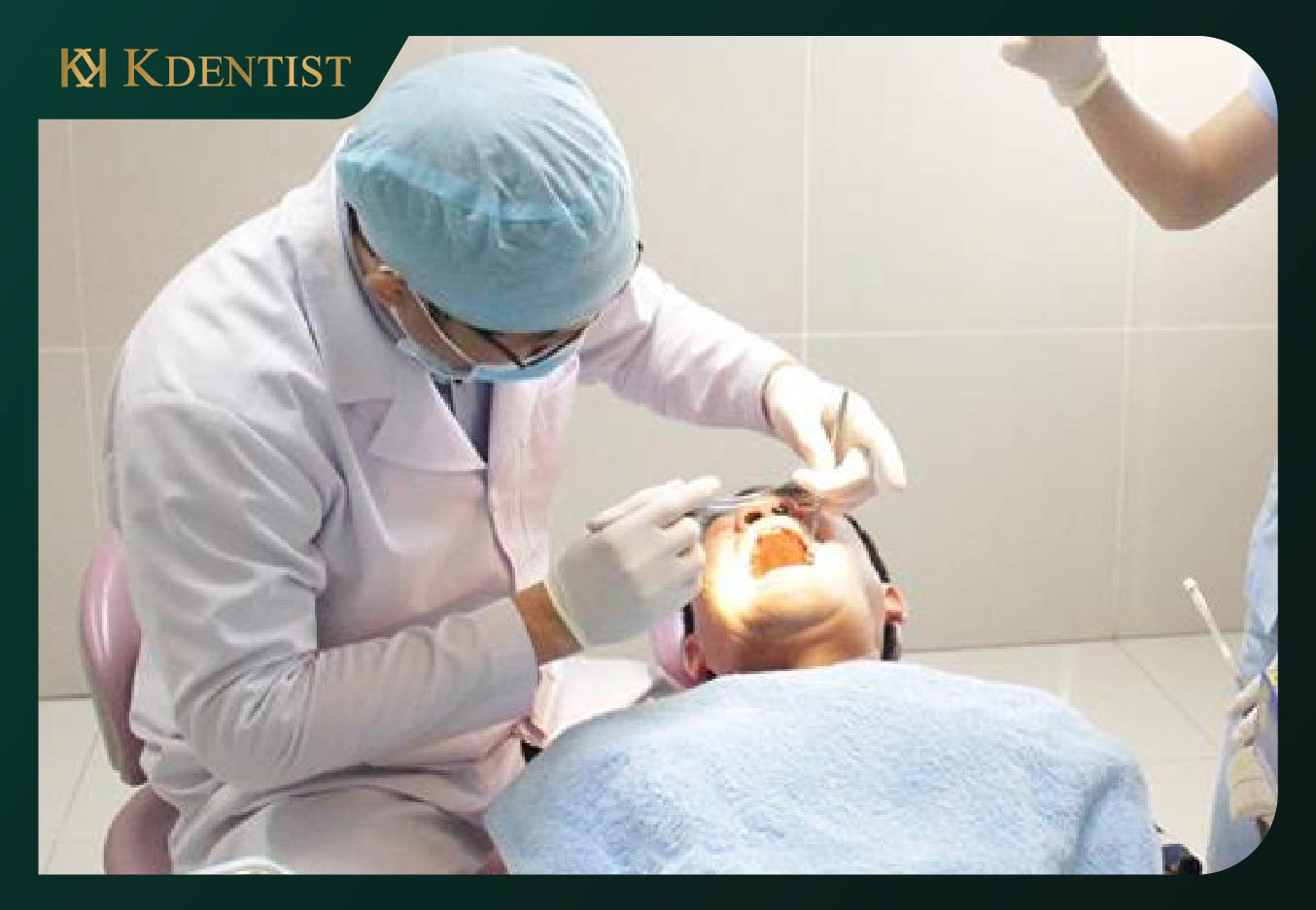 Vậy cấy ghép implant có tốt không?