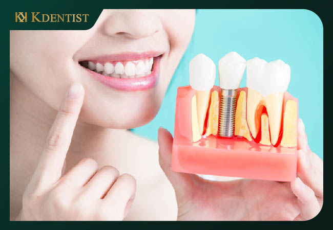 Cải thiện tốt khả năng ăn uống Cải thiện tốt khả năng ăn uống