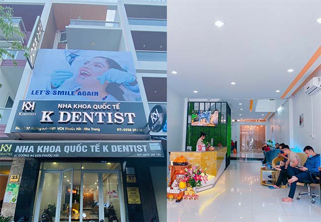 Phòng khám nha khoa nha trang KDENTIST