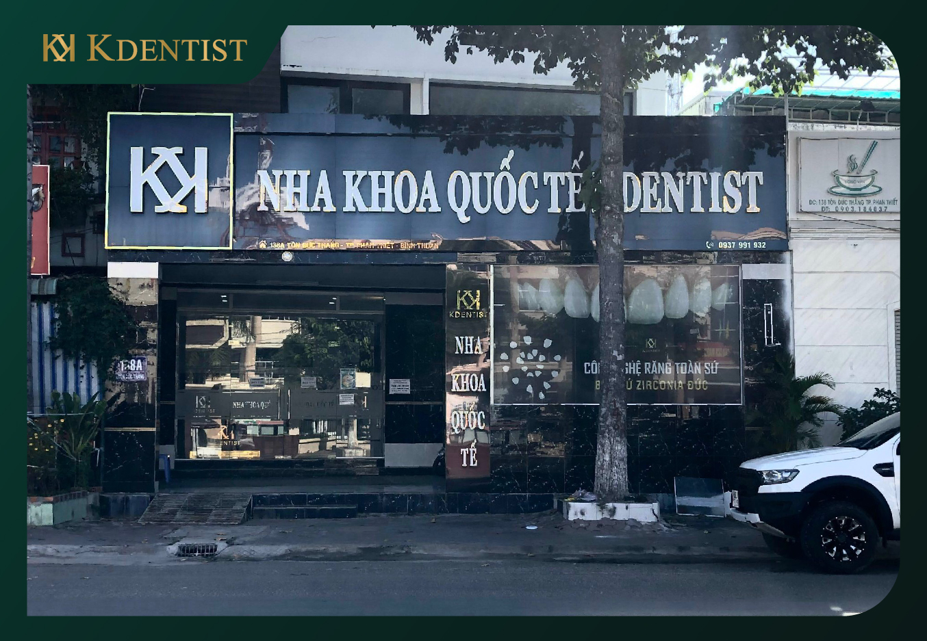 Giới thiệu về nha khoa Phan Thiết KDENTIST
