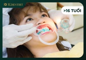 Đối tượng không nên tẩy trắng răng