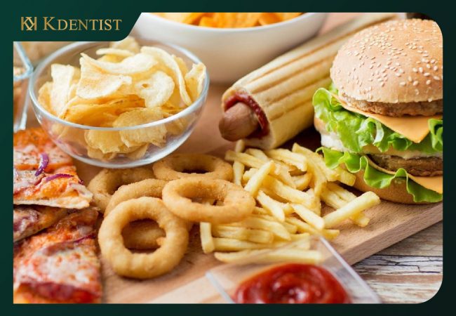 Kiêng những món ăn vặt Kiêng những món ăn vặt