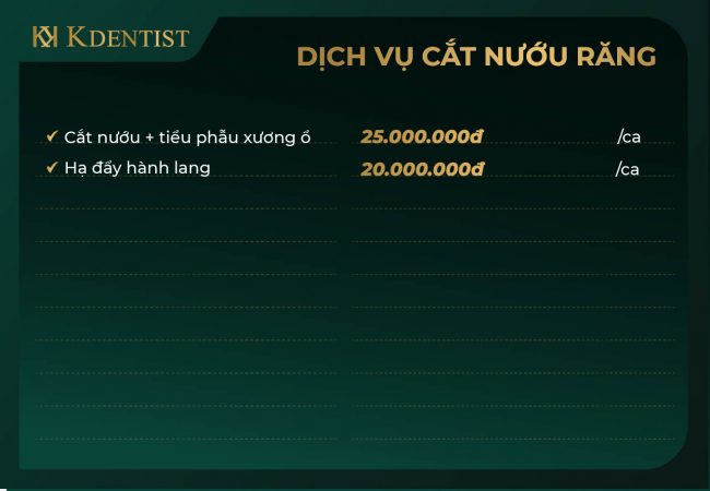 Bảng giá điều trị cười hở lợi Bảng giá điều trị cười hở lợi