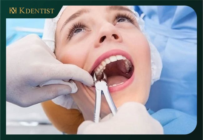 Dịch vụ nhổ răng tại nha khoa Quảng Ngãi Dịch vụ nhổ răng tại nha khoa Quảng Ngãi