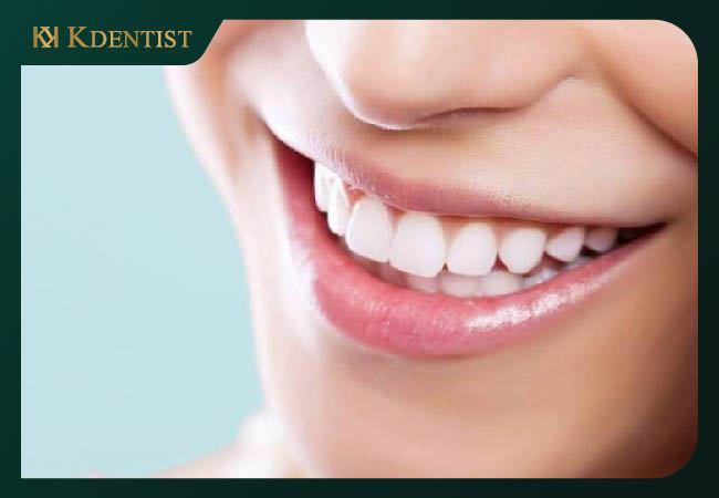 Giá trị thẩm mĩ cao Giá trị thẩm mĩ cao
